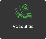 Vasculitis